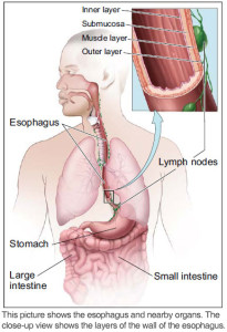 esophagus1-205x300